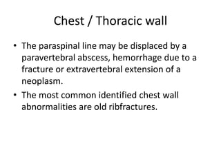 Chest / Thoracic wall
• The paraspinal line may be displaced by a
paravertebral abscess, hemorrhage due to a
fracture or extravertebral extension of a
neoplasm.
• The most common identified chest wall
abnormalities are old ribfractures.
 