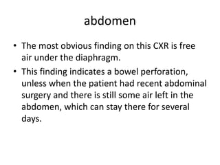 abdomen
• The most obvious finding on this CXR is free
air under the diaphragm.
• This finding indicates a bowel perforation,
unless when the patient had recent abdominal
surgery and there is still some air left in the
abdomen, which can stay there for several
days.
 