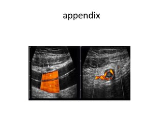 appendix
 