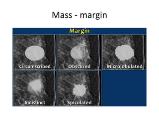 Mass - margin
 
