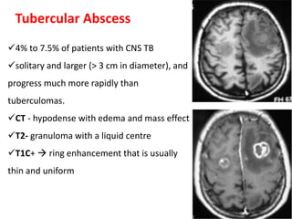 Tubercular Abscess
4% to 7.5% of patients with CNS TB
solitary and larger (> 3 cm in diameter), and
progress much more rapidly than
tuberculomas.
CT - hypodense with edema and mass effect
T2- granuloma with a liquid centre
T1C+  ring enhancement that is usually
thin and uniform
 