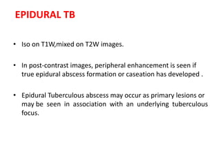 EPIDURAL TB
• Iso on T1W,mixed on T2W images.
• In post-contrast images, peripheral enhancement is seen if
true epidural abscess formation or caseation has developed .
• Epidural Tuberculous abscess may occur as primary lesions or
may be seen in association with an underlying tuberculous
focus.
 