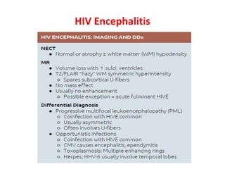 HIV Encephalitis
 