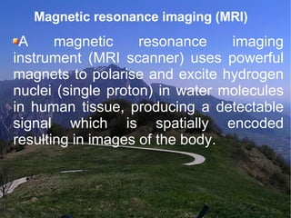 Magnetic resonance imaging (MRI)  A magnetic resonance imaging instrument (MRI scanner) uses powerful magnets to polarise and excite hydrogen nuclei (single proton) in water molecules in human tissue, producing a detectable signal which is spatially encoded resulting in images of the body. 