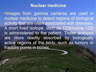 Nuclear medicine Images from gamma cameras are used in nuclear medicine to detect regions of biological activity that are often associated with diseases. A short lived isotope, such as 123I(Iodine-123) is administered to the patient. These isotopes are more readily absorbed by biologically active regions of the body, such as tumors or fracture points in bones. 