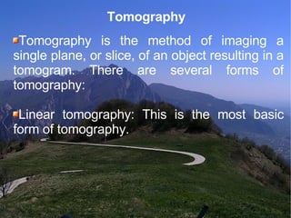 Tomography Tomography is the method of imaging a single plane, or slice, of an object resulting in a tomogram. There are several forms of tomography: Linear tomography: This is the most basic form of tomography. 