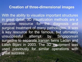 Creation of three-dimensional images With the ability to visualize important structures in great detail, 3D visualization methods are a valuable resource for the diagnosis and surgical treatment of many pathologies. It was a key resource for the famous, but ultimately unsuccessful attempt by Singaporean surgeons to separate Iranian twins Ladan and Laleh Bijani in 2003. The 3D equipment was used previously for similar operations with great success. 