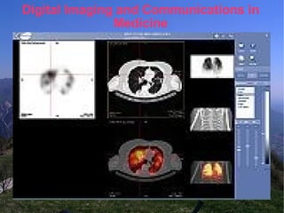 Digital Imaging and Communications in Medicine 