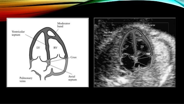baby heart doppler cvs