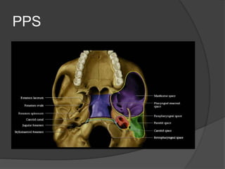 Pps Radiopaedia Imaging of the neck part i | PPTX