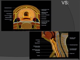 Imaging of the neck part i | PPTX
