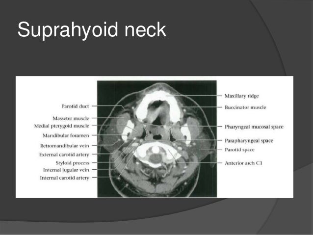 Imaging of the neck part i