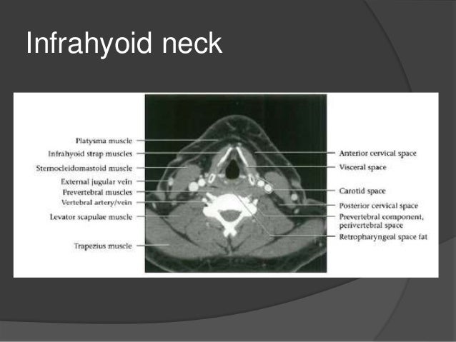 Imaging of the neck part i