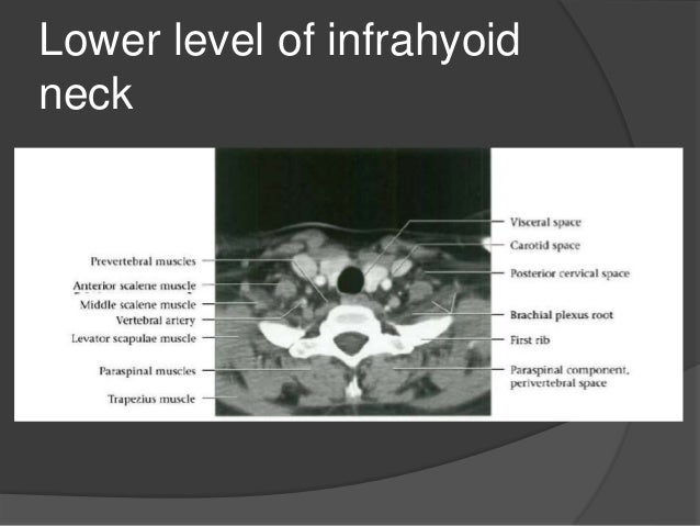Imaging of the neck part i