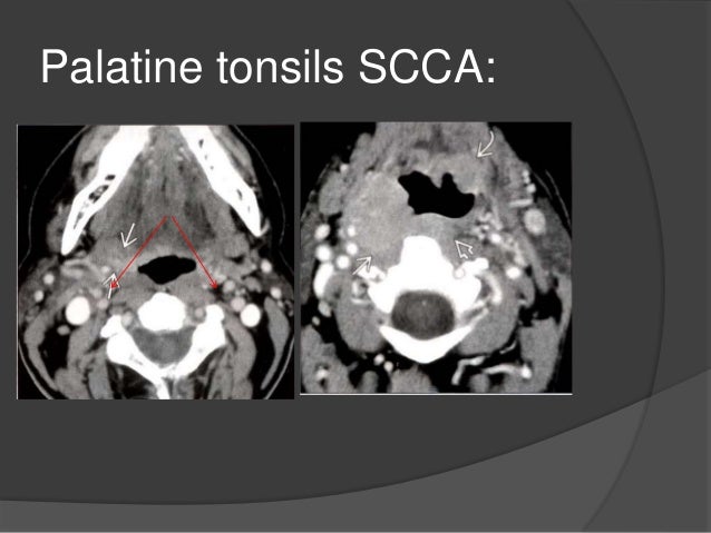 Imaging of the neck part ii