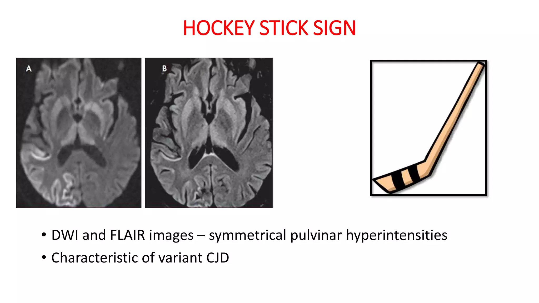 Imaging neurology spotters | PPTX
