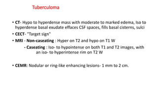 Tuberculoma
• CT- Hypo to hyperdense mass with moderate to marked edema, Iso to
hyperdense basal exudate effaces CSF spaces, fills basal cisterns, sulci
• CECT- "Target sign"
• MRI - Non-caseating : Hyper on T2 and hypo on T1 W
- Caseating : Iso- to hypointense on both T1 and T2 images, with
an iso- to hyperintense rim on T2 W
• CEMR: Nodular or ring-like enhancing lesions- 1 mm to 2 cm.
 