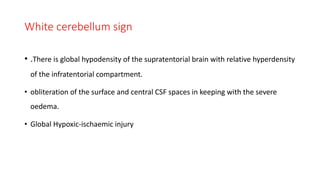 White cerebellum sign
• .There is global hypodensity of the supratentorial brain with relative hyperdensity
of the infratentorial compartment.
• obliteration of the surface and central CSF spaces in keeping with the severe
oedema.
• Global Hypoxic-ischaemic injury
 