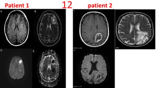 Patient 1 patient 212
 