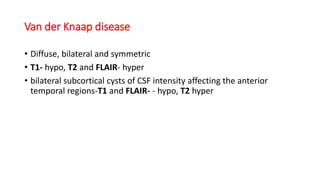Van der Knaap disease
• Diffuse, bilateral and symmetric
• T1- hypo, T2 and FLAIR- hyper
• bilateral subcortical cysts of CSF intensity affecting the anterior
temporal regions-T1 and FLAIR- - hypo, T2 hyper
 