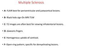 Multiple Sclerosis
• A- FLAIR best for periventricular and juxtacortical lesions.
• B- Black hole sign On MRI T1W
• C- T2 images are often best for viewing infratentorial lesions.
• D- dawsons fingers
• E- Homogenous uptake of contrast.
• F- Open-ring pattern, specific for demyelinating lesions.
 
