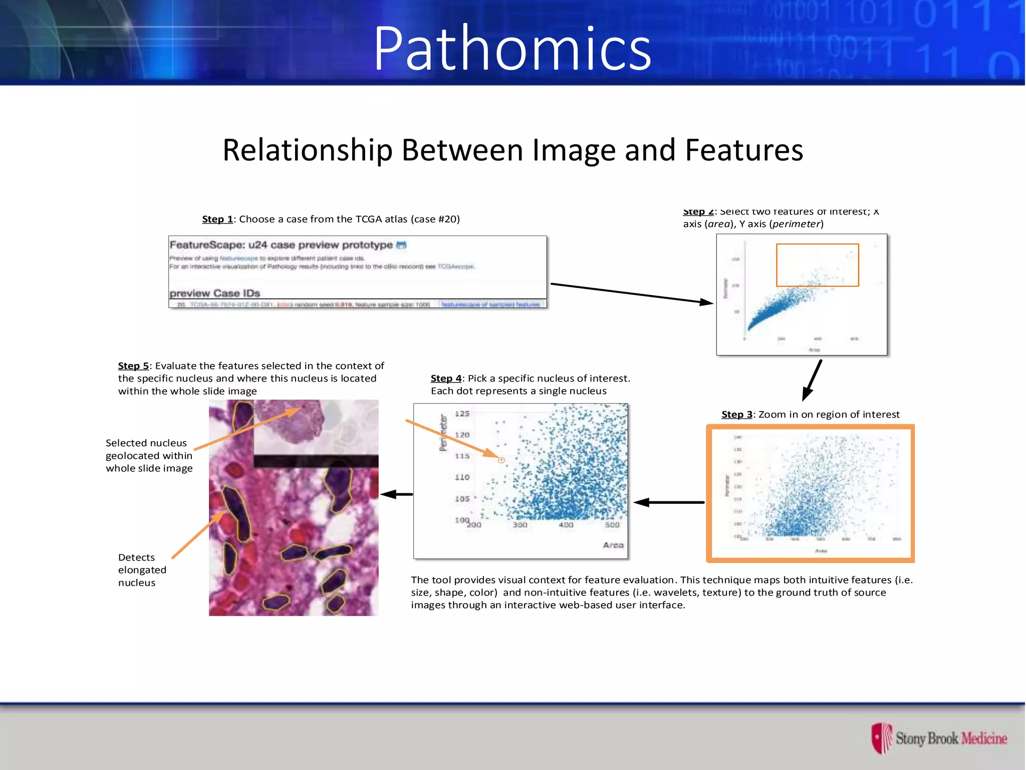 Pathomics
Relationship Between Image and FeaturesLeveraging Visualization to Aid in Feature Management
Step 1: Choose a case from the TCGA atlas (case #20)
Step 2: Select two features of interest; X
axis (area), Y axis (perimeter)
Step 3: Zoom in on region of interest
Step 4: Pick a specific nucleus of interest.
Each dot represents a single nucleus
Step 5: Evaluate the features selected in the context of
the specific nucleus and where this nucleus is located
within the whole slide image
The tool provides visual context for feature evaluation. This technique maps both intuitive features (i.e.
size, shape, color) and non-intuitive features (i.e. wavelets, texture) to the ground truth of source
images through an interactive web-based user interface.
Selected nucleus
geolocated within
whole slide image
Detects
elongated
nucleus
Going from the whole slide data set to selected features and back to the image
Adding a visual perspective by using a live web-based interactive tool (http://sbu-bmi.github.io/featurescape/u24/Preview.html)
 