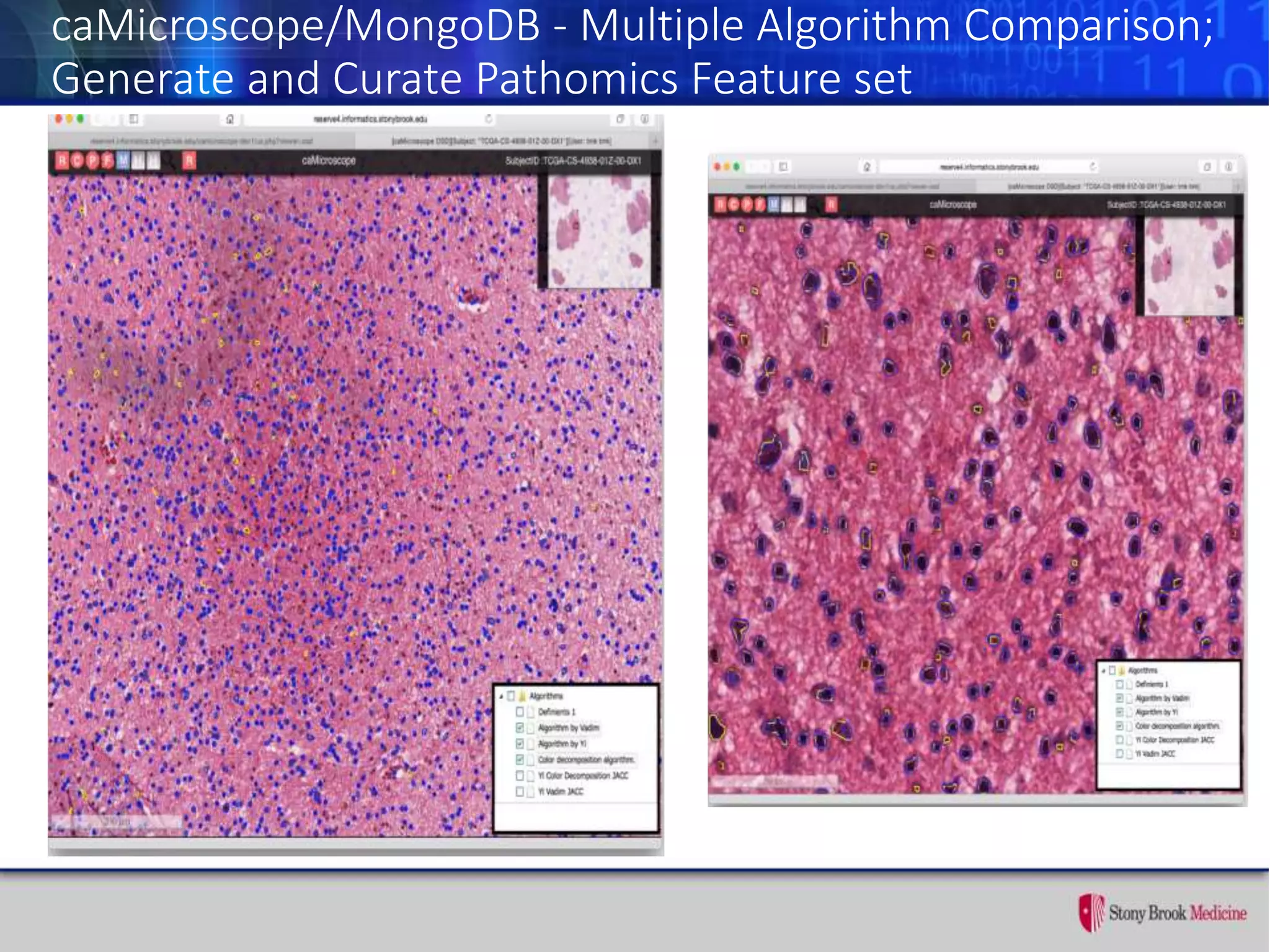 caMicroscope/MongoDB - Multiple Algorithm Comparison;
Generate and Curate Pathomics Feature set
 