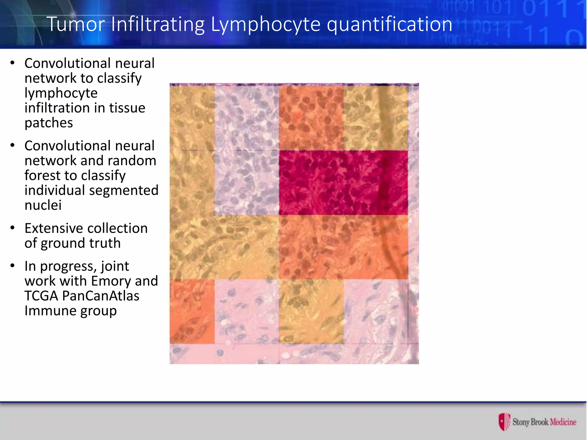 Tumor Infiltrating Lymphocyte quantification
• Convolutional neural
network to classify
lymphocyte
infiltration in tissue
patches
• Convolutional neural
network and random
forest to classify
individual segmented
nuclei
• Extensive collection
of ground truth
• In progress, joint
work with Emory and
TCGA PanCanAtlas
Immune group
 