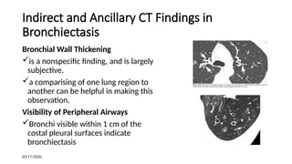 Radiology of airway disease(bronchiectasis | PPTX