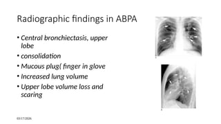 Radiology of airway disease(bronchiectasis | PPTX