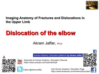 Dr.AkramJaffar
Imaging Anatomy of Fractures and Dislocations inImaging Anatomy of Fractures and Dislocations in
the Upper Limbthe Upper Limb
Dislocation of the elbowDislocation of the elbow
Akram Jaffar, Ph.D.
Subscribe to Human Anatomy Education Channel
https://www.youtube.com/user/akramjfr
Human Anatomy Education platforms by Akram Jaffar
Follow @AkramJaffar Like Human Anatomy Education Page
https://www.facebook.com/AnatomyEducation
 