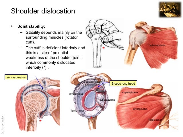 Imaging anatomy dislocation of the shoulder