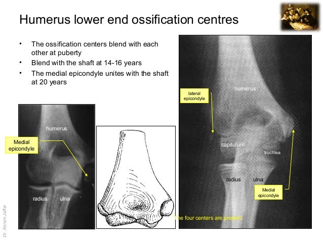 Imaging anatomy fracture of olecranon