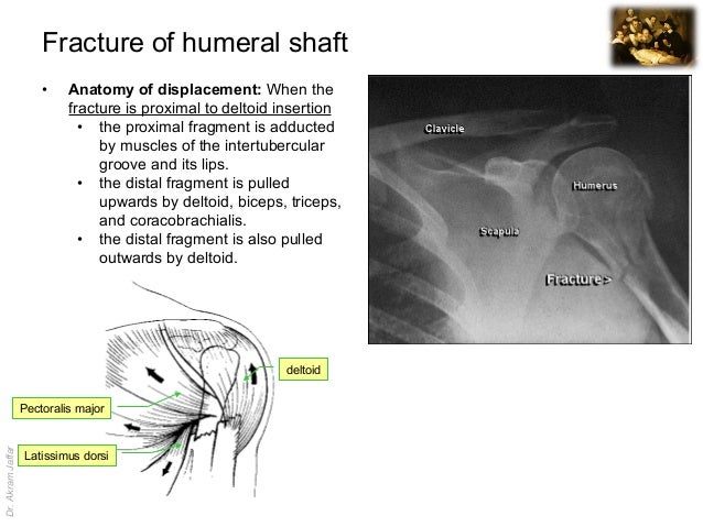 Imaging anatomy fractures of the humerus