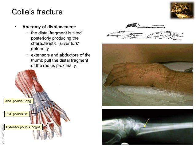 Imaging anatomy fractures of the radius