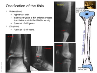 Imaging anatomy injuries of the leg and foot | PPT | Free Download