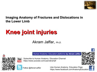 Dr.AkramJaffar
Imaging Anatomy of Fractures and Dislocations inImaging Anatomy of Fractures and Dislocations in
the Lower Limbthe Lower Limb
Knee joint injuriesKnee joint injuries
Akram Jaffar, Ph.D.
Subscribe to Human Anatomy Education Channel
https://www.youtube.com/user/akramjfr
Human Anatomy Education platforms by Akram Jaffar
Follow @AkramJaffar Like Human Anatomy Education Page
https://www.facebook.com/AnatomyEducation
 