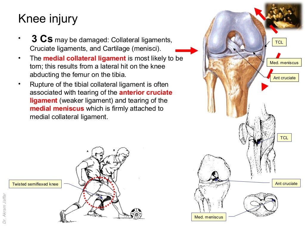 Imaging anatomy knee injuries