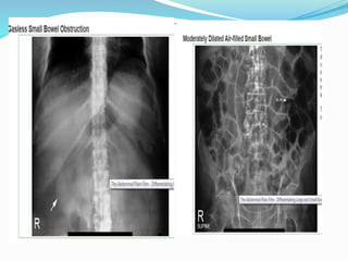Small Intestine String. Sign Imaging anatomy of small intestine | PPTX