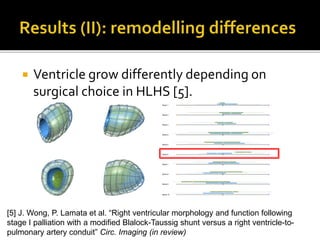  Ventricle grow differently depending on
surgical choice in HLHS [5].
[5] J. Wong, P. Lamata et al. “Right ventricular morphology and function following
stage I palliation with a modified Blalock-Taussig shunt versus a right ventricle-to-
pulmonary artery conduit” Circ. Imaging (in review)
 