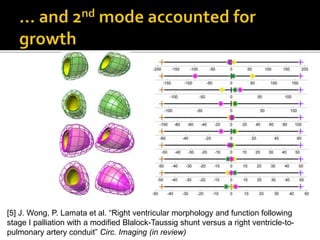 [5] J. Wong, P. Lamata et al. “Right ventricular morphology and function following
stage I palliation with a modified Blalock-Taussig shunt versus a right ventricle-to-
pulmonary artery conduit” Circ. Imaging (in review)
 
