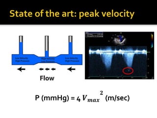P (mmHg) = 4 𝑽 𝒎𝒂𝒙
𝟐
(m/sec)
 