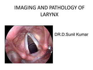 IMAGING AND PATHOLOGY OF
LARYNX
DR.D.Sunil Kumar
 