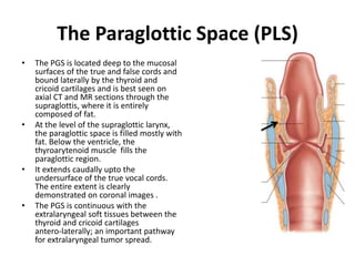 Pre-Epiglottic Space (PES)
• The pre-epiglottic space (PES) is a
fat-filled space, rich in
lymphatics.
• It is bound super...