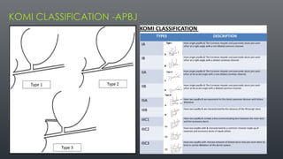 IMAGING APPROACH TO OBSTRUCTIVE JAUNDICE.pptx
