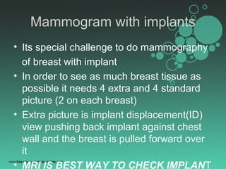 Imaging breast mammogram Slide 48