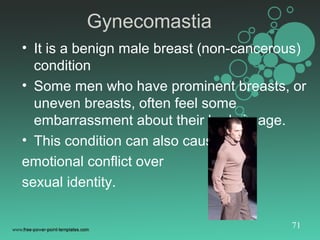 Imaging breast mammogram Slide 71