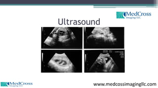 Ultrasound
www.medcossimagingllc.com
 