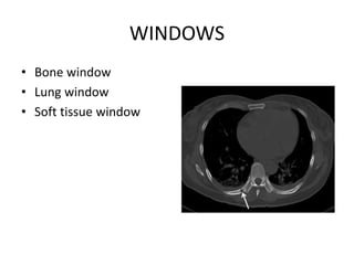 WINDOWS
• Bone window
• Lung window
• Soft tissue window
 