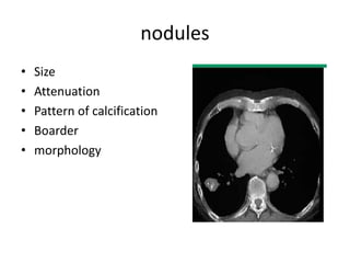 nodules
• Size
• Attenuation
• Pattern of calcification
• Boarder
• morphology
 